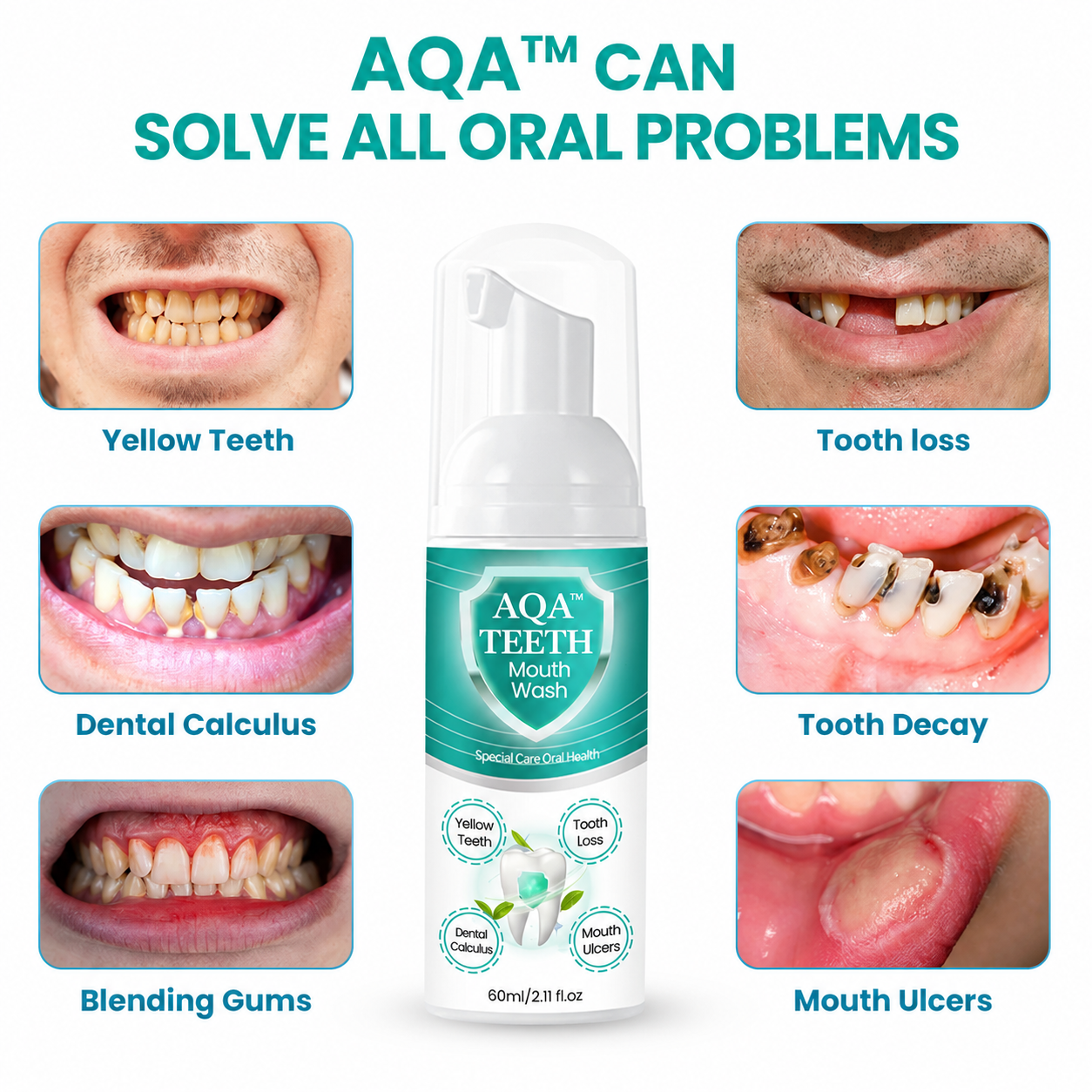 2026 Sale 70% OFF 🦷✨ AQA™ TEETH Herbal Mouthwash 🌿 Solve all Oral Problems