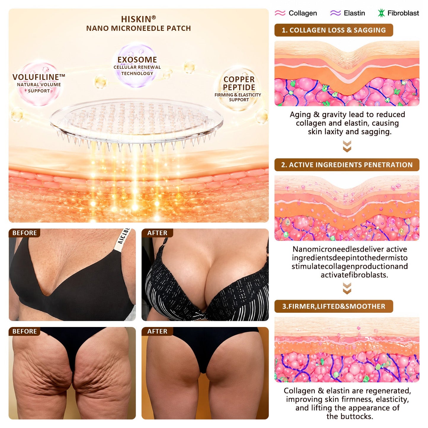 Nexisify®🏆 Bust Volume, Lift & Firming Nano Microneedle Patch Volufiline + Exosome + Copper Peptide Formula Powered by Cellular Renewal Technology