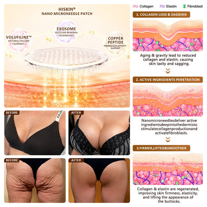 Nexisify®🏆 Bust Volume, Lift & Firming Nano Microneedle Patch Volufiline + Exosome + Copper Peptide Formula Powered by Cellular Renewal Technology