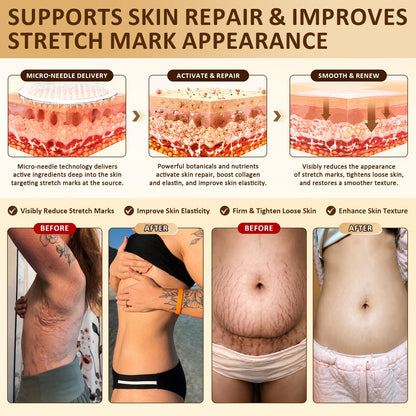 Nexisify®🏆 Bust Volume, Lift & Firming Nano Microneedle Patch Volufiline + Exosome + Copper Peptide Formula Powered by Cellular Renewal Technology